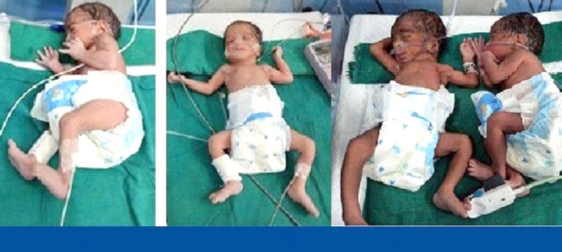‘हुर्काउनै मुस्किल चार अमूल्य उपहार’