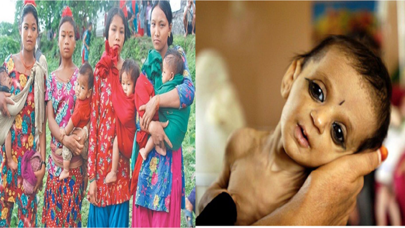 २० वर्ष नपुग्दै विवाह : अधिकांश बच्चा कुपोषित