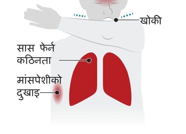 कोरोनाभाइरस: सङ्क्रमण भएपछि यसले मानिसको शरीरमा के गर्छ?