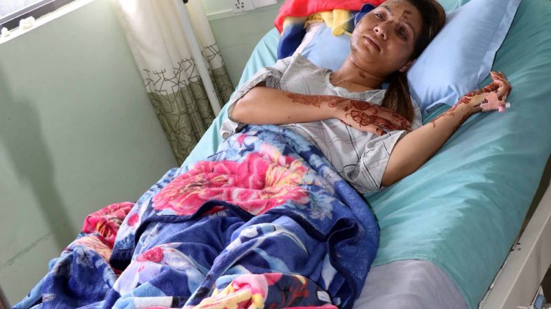 तेजाब प्रहारबाट घाइते युवतीलाई मन्त्री ढकालले भन्नुभयो, “ उपचारमा सरकारले सहयोग गर्छ”